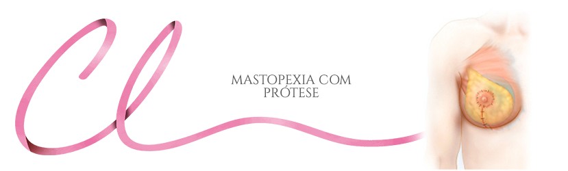 Mastopexia com Prótese