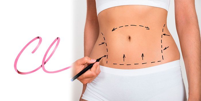 10 Dicas de Como Perder Gordura Localizada Através da Cirurgia Plástica