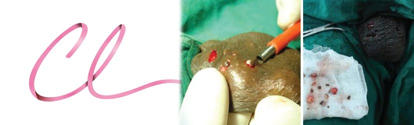 Ilustração de uma Cirurgia de Calcinose Escrotal