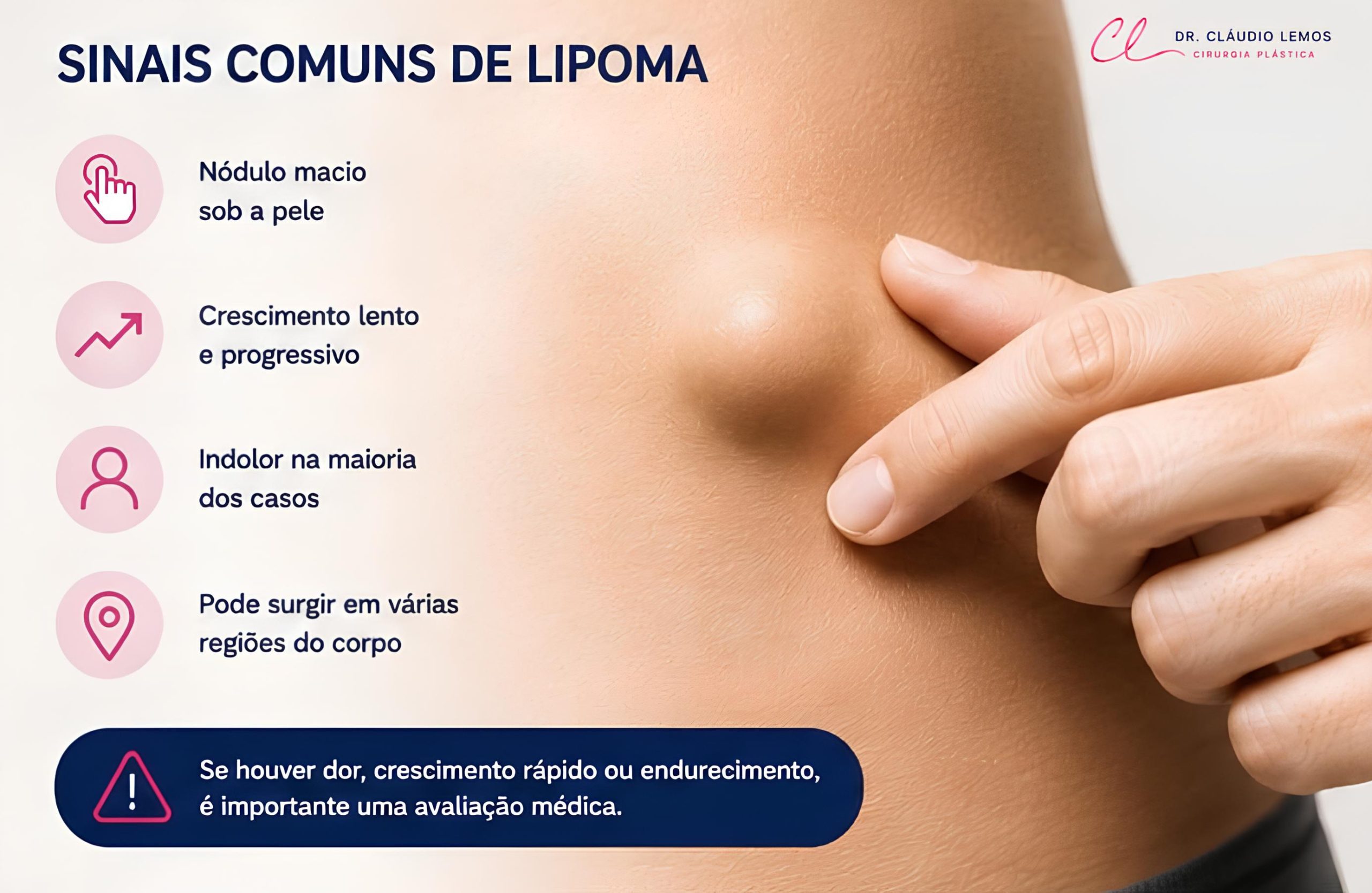 Ilustração de sinais comuns de Limpoma