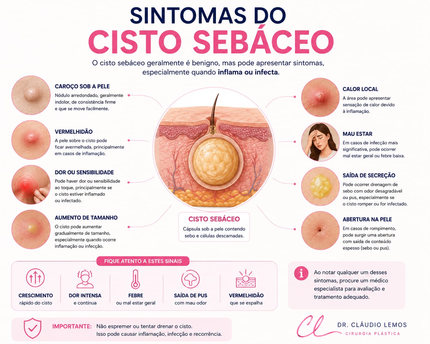 imagem que ilustra os sintomas cisto sebáseo